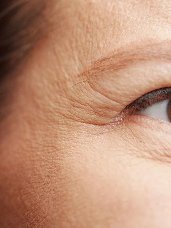 Muestra de patas de gallo.